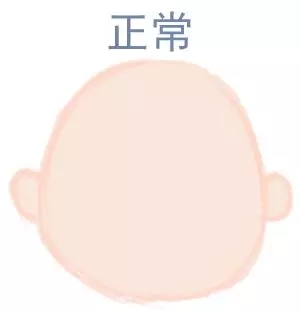 宝宝圆头好还是扁头好？这些奥秘好多爸妈都不知路5.webp.jpg